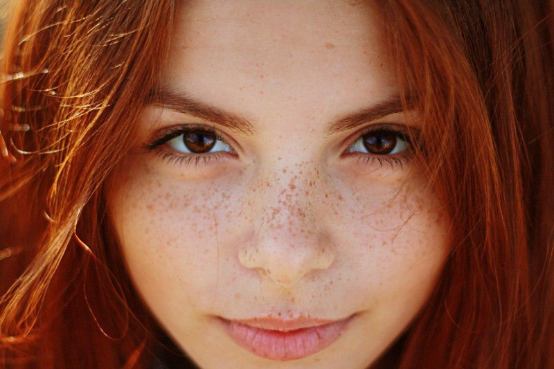 Lighten-Your-Sexy-Freckles
