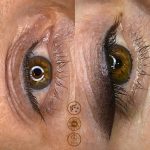 Ημιμόνιμο Μακιγιάζ Βλεφάρων- eyeliner με σκιά