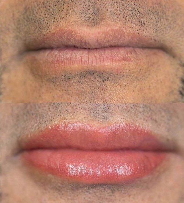 Lip-Blushing-results-in-men-caused-by-sun-damage-1296×728-slide4